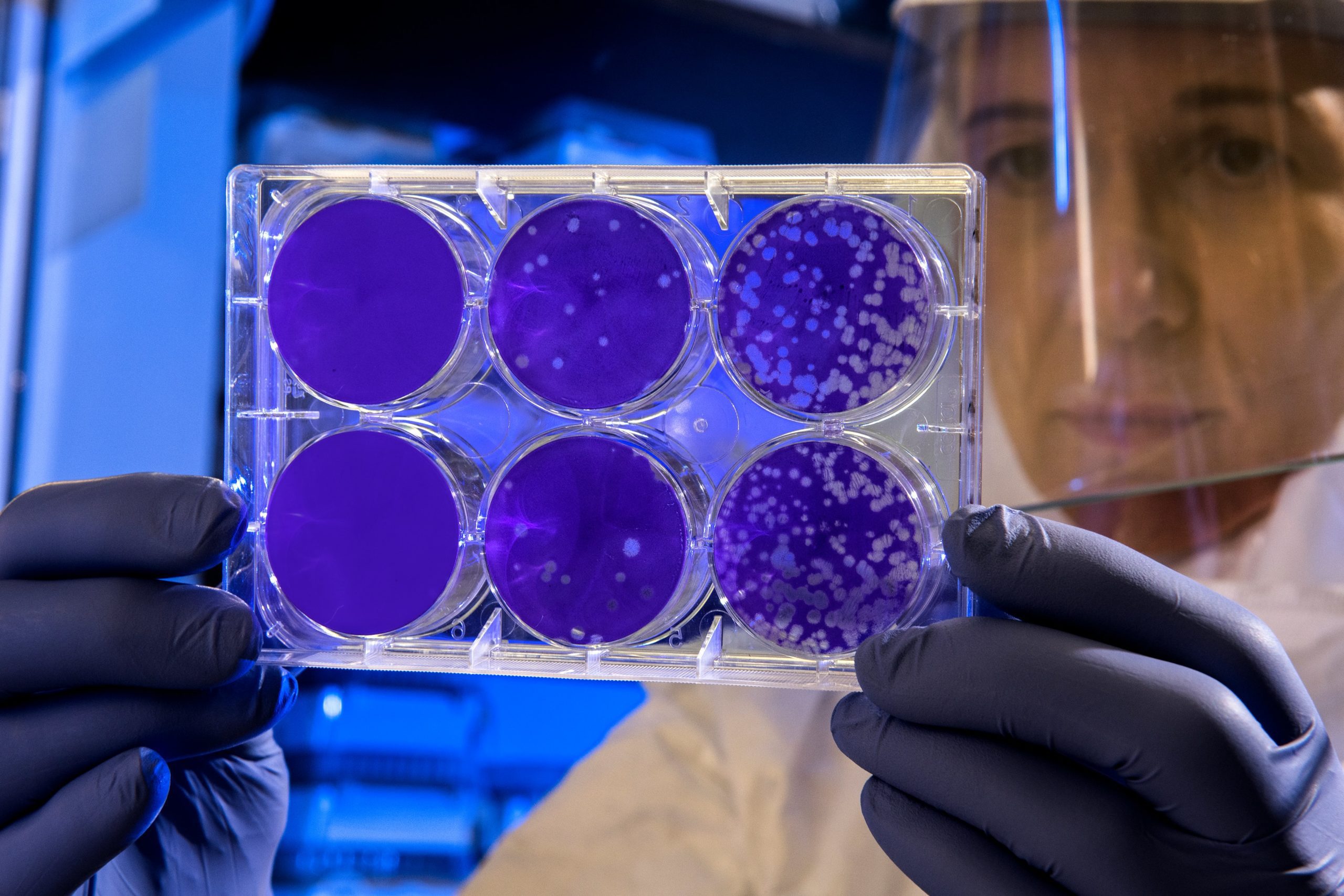 Former FDA Head Says CDC Guidance Hurt Pandemic Response