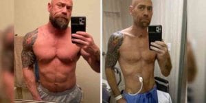 Nurse shares dramatic before and after photos after long fight against coronavirus