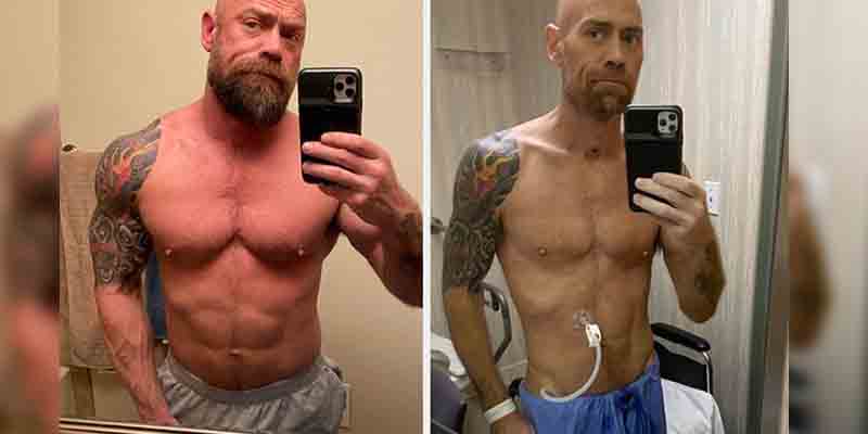 Nurse Shares Dramatic Before and After Photos After Long Fight Against Coronavirus