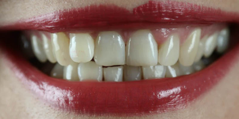 "Mask Mouth" is rotting people's teeth, New York City Dentist Claims