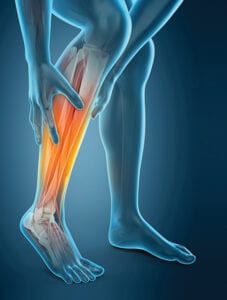 Get a "leg up" on vascular health at deborah's pad screening event