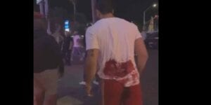 Padres outfielder tommy pham stabbed outside sand diego strip club