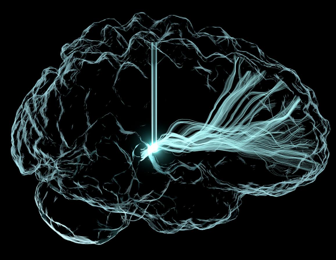 Thursday, November 19, 2020 New NIH BRAIN Initiative awards move toward solving brain disorders