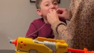 Watch as dad pulls son's loose tooth with nerf gun shot