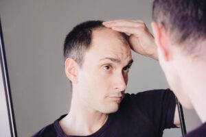 Why am i losing my hair and what can i do about it?