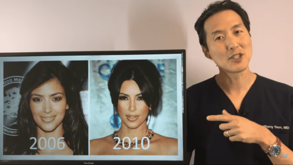 Kim kardashians ever changing face analyzed by plastic surgeon - photo licensed by shore news network.