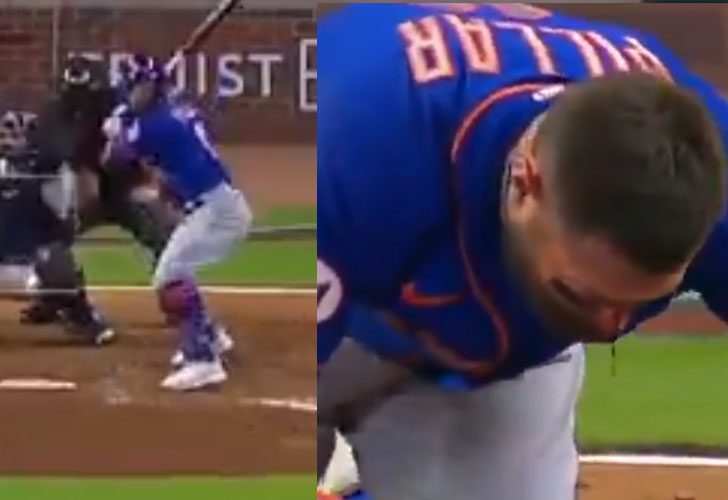 Mets Kevin Pillar takes 94 MPH fastball to the face, recovering with facial fractures