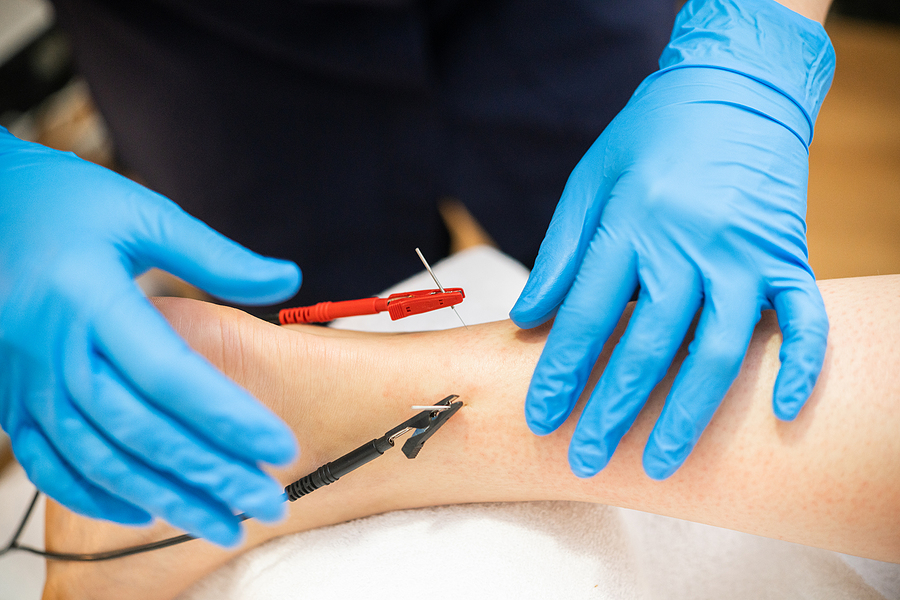 Democrat bill to allow 'dry needling' in New Jersey passes Senate vote