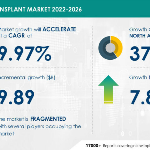 Hair transplant market to record usd 9. 89 bn growth | driven by rising cases of male pattern baldness | technavio - photo licensed by shore news network.