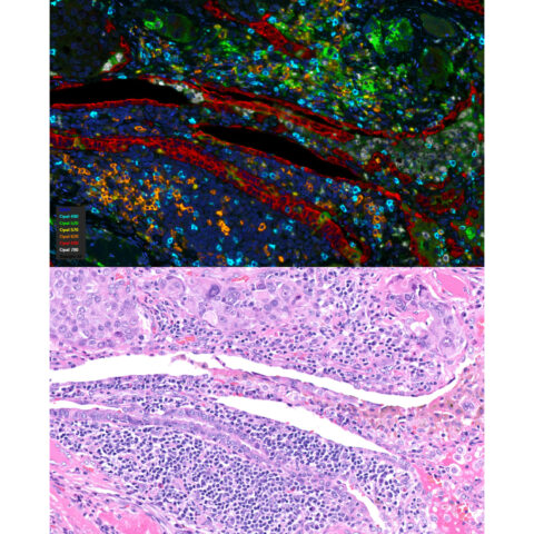 Icura diagnostics became the first fully qualified multiplex ihc/if service partner of akoya biosciences - photo licensed by shore news network.