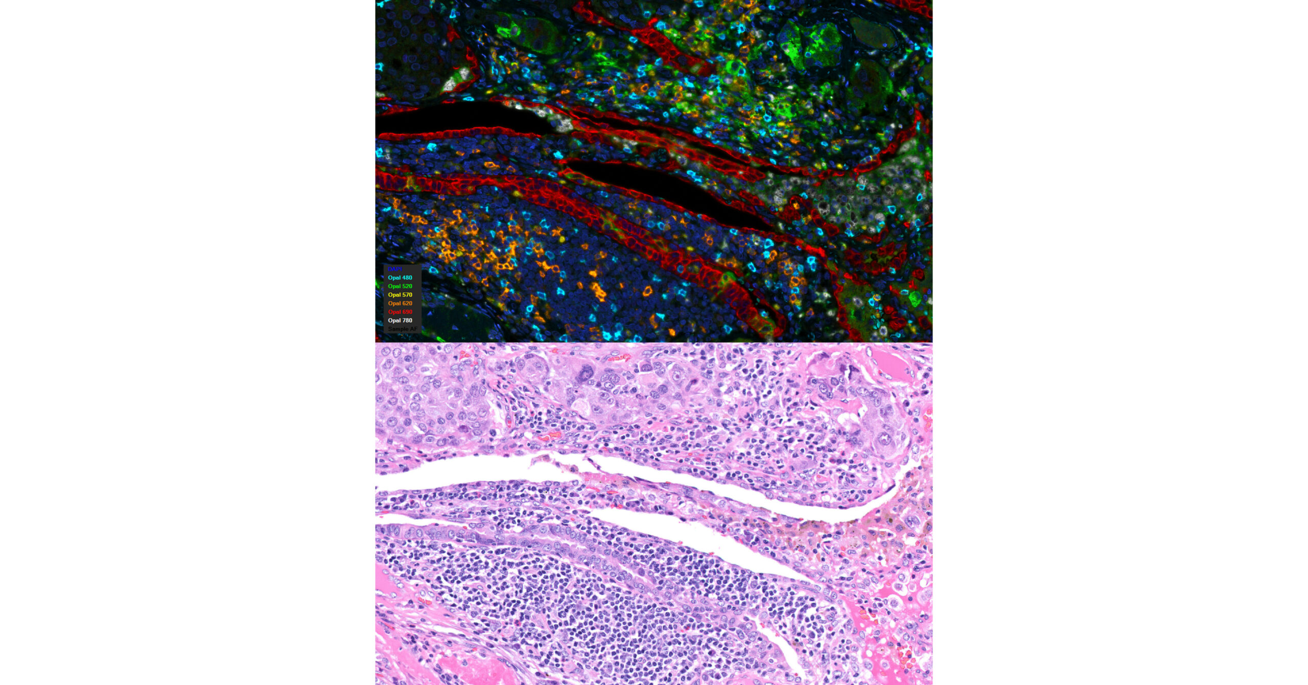 iCura Diagnostics Became The First Fully Qualified Multiplex IHC/IF Service Partner of Akoya Biosciences