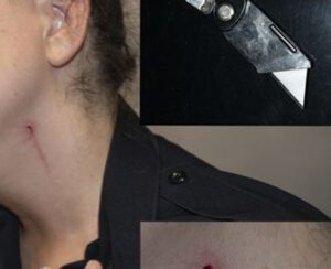 Female yonkers cop slashed in neck, face with box cutter during domestic violence call