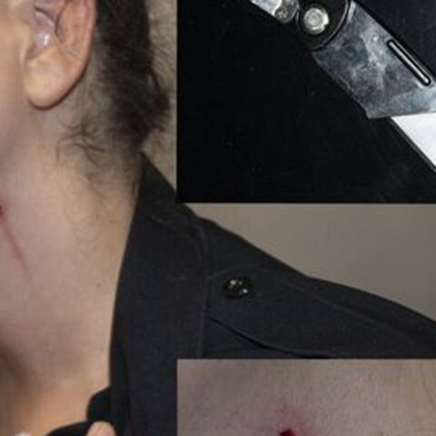 Female yonkers cop slashed in neck, face with box cutter during domestic violence call - photo licensed by shore news network.