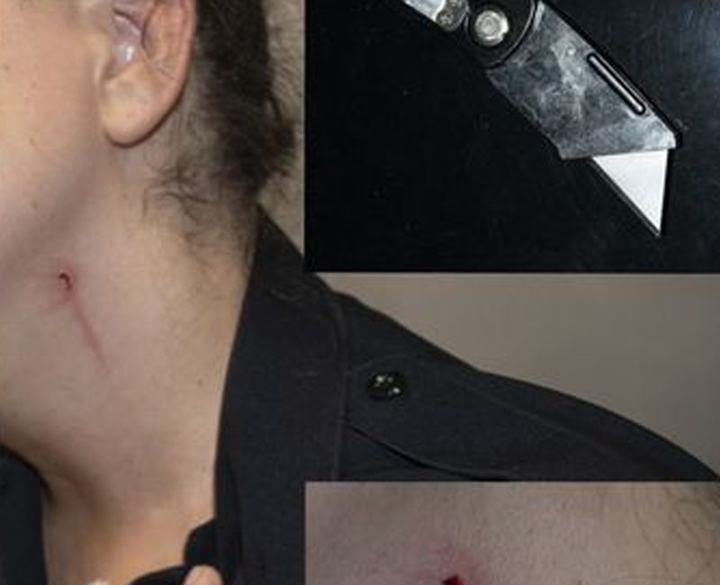 Female Yonkers Cop Slashed in Neck, Face With Box Cutter During Domestic Violence Call