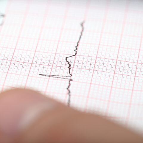 Investigating a possible earthquake on a seismograph.