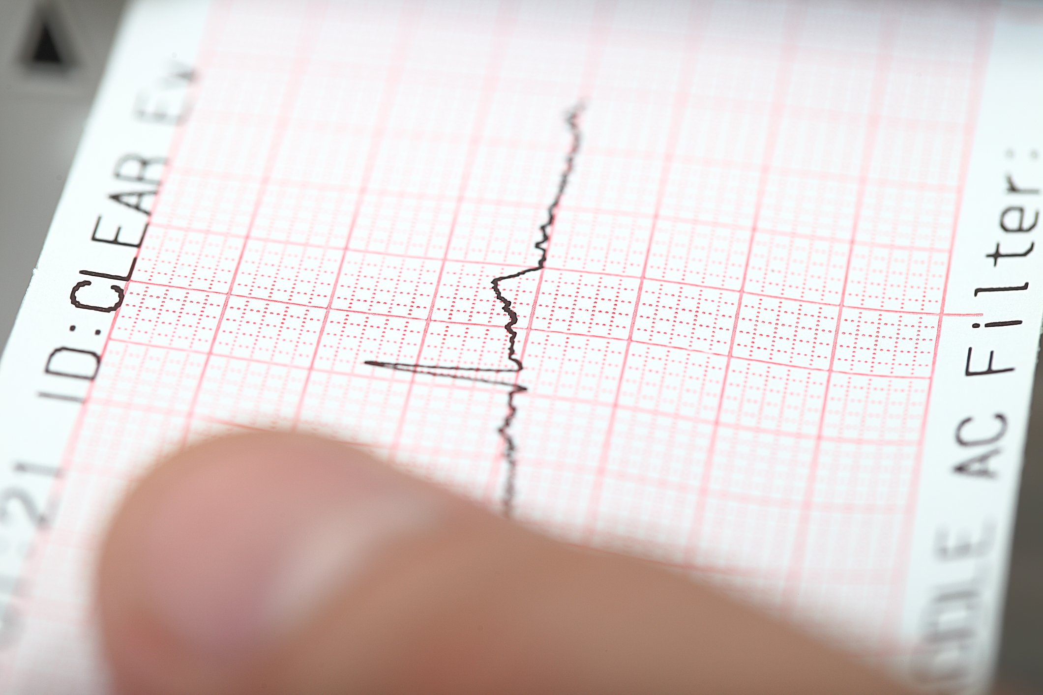 Investigating a possible earthquake on a seismograph.