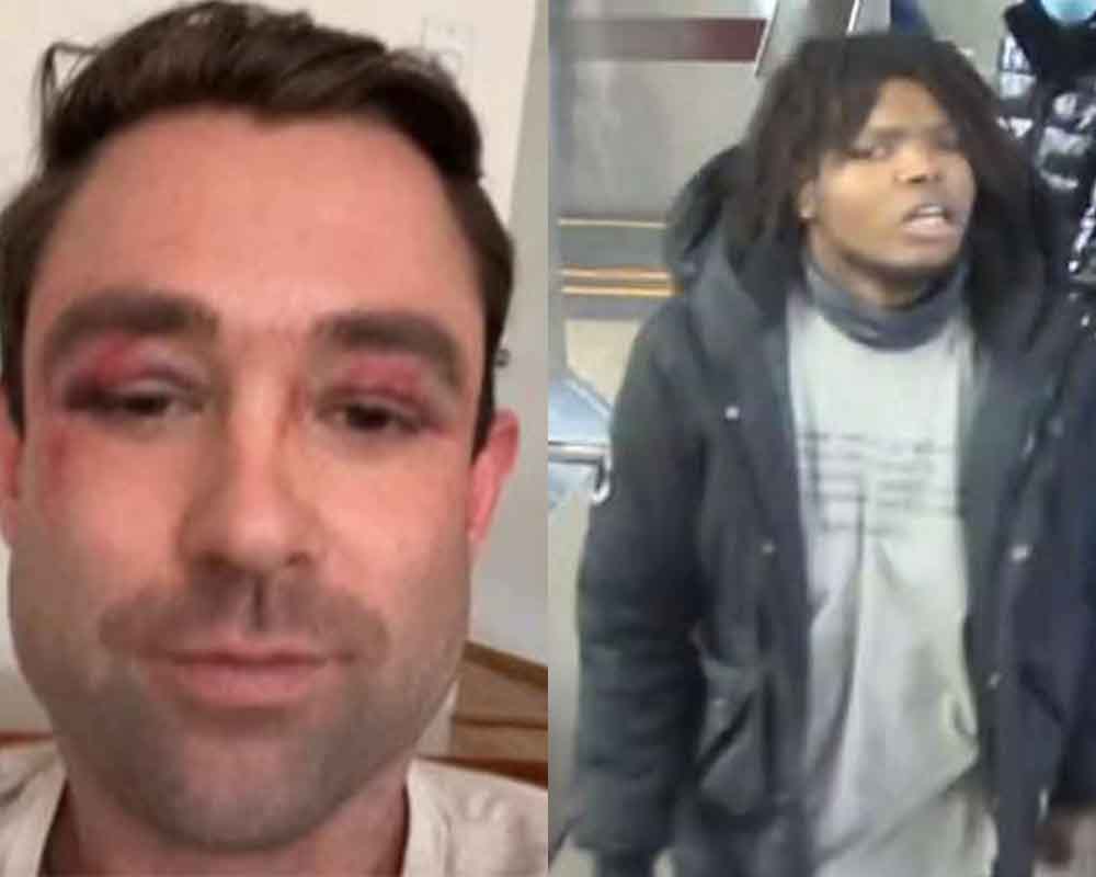 At large suspect wanted for assault against Fox News weather man Adam Klotz.