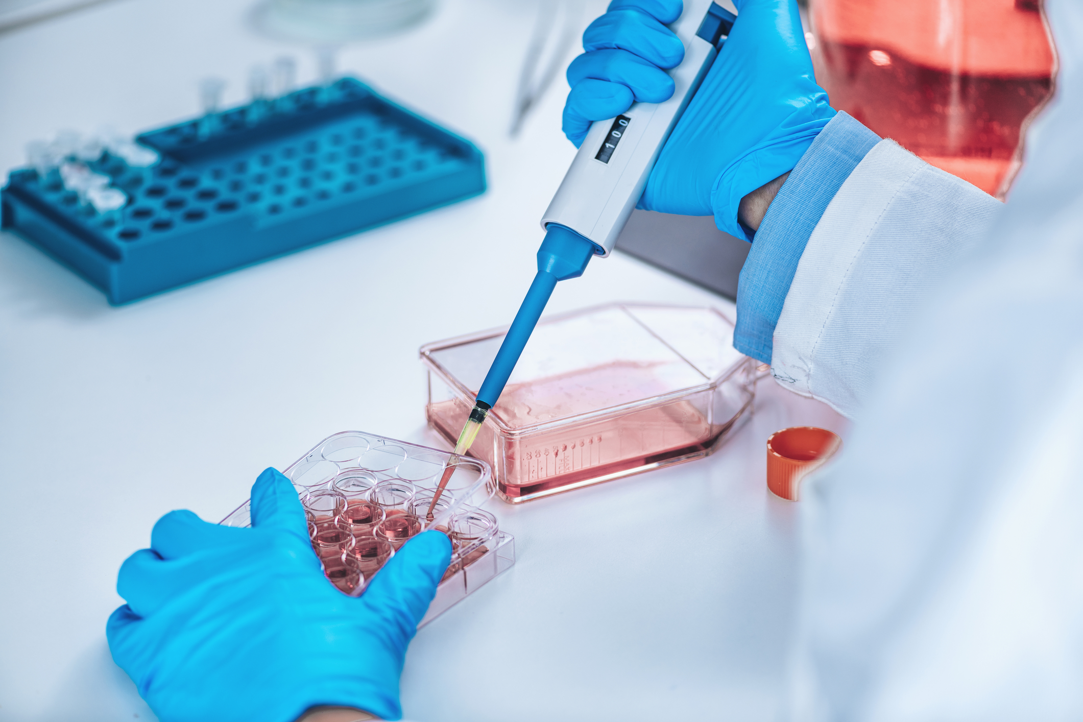 Lab-Grown Meat Firms Don’t Know If Their Food Is Safe Long-Term: REPORT