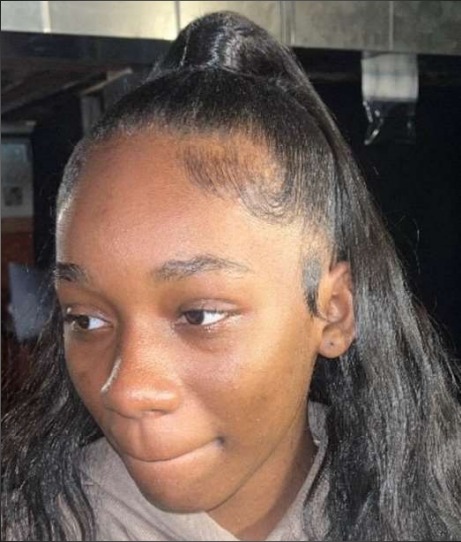 13-year-old reported missing in Baltimore