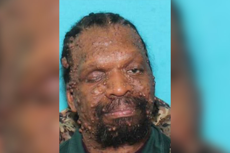 60-Year-Old Man Missing in Philadelphia