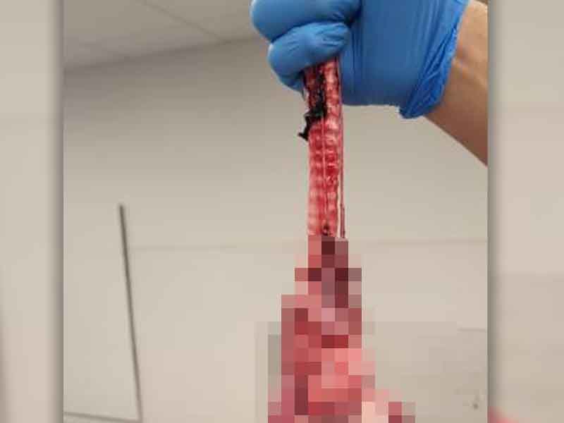 Gutted, Mutilated Goat Seized at O'Hare International Airport