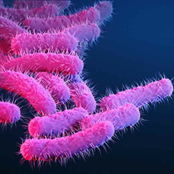 Shigella bacteria cause an infection called shigellosis. Shigella cause an estimated 450,000 infections in the united states each year and an estimated $93 million in direct medical costs.