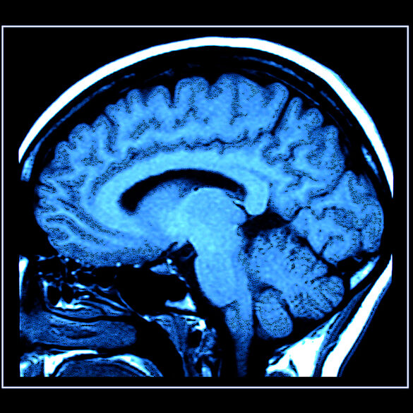 Brain untrust: new jersey man defrauded brain injury fund out of $4 million - photo licensed by shore news network.