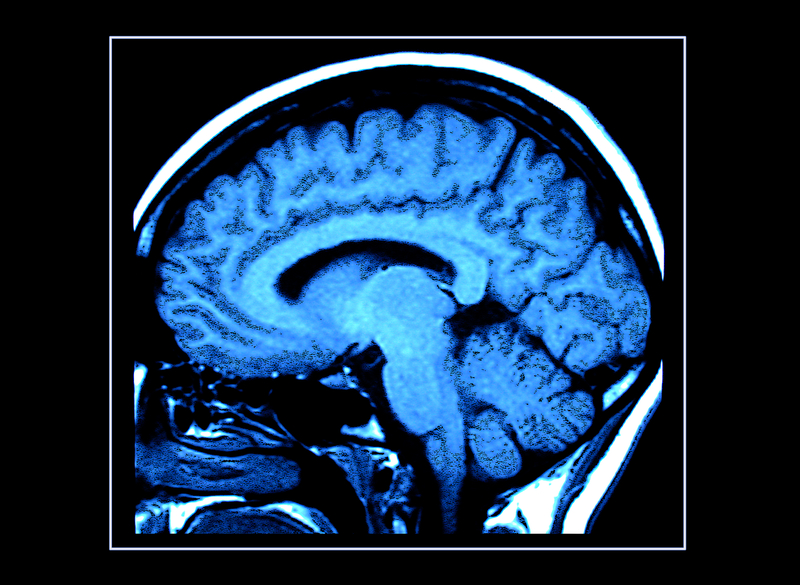 Brain UnTrust: New Jersey Man Defrauded Brain Injury Fund Out of $4 Million