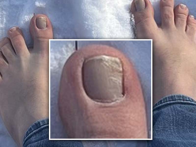 Bill Spadea's Potential Toe Fungus Becomes Center of New Jersey Gubernatorial Debate Online