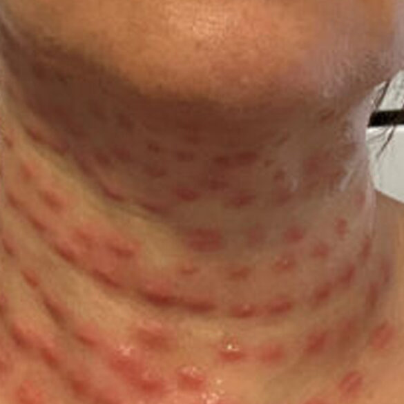 Flushing cosmetologist charged with assault for unauthorized beauty treatments - photo licensed by shore news network.