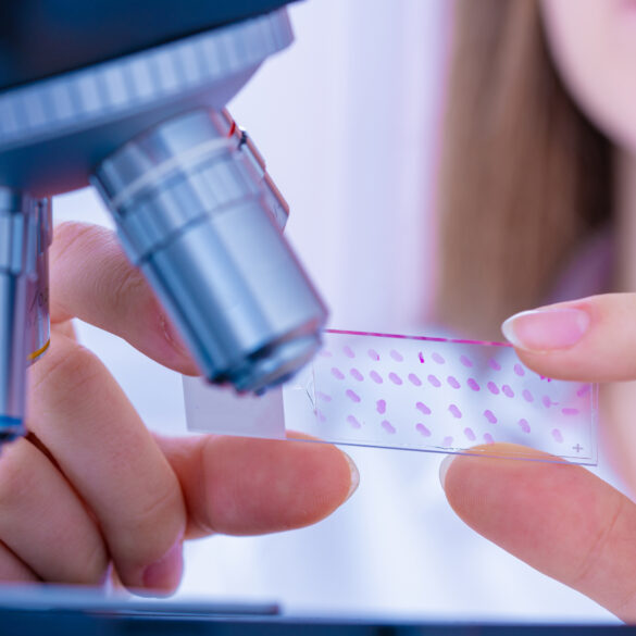 New jersey senate panel advances bill to boost cancer research funding tenfold - photo licensed by shore news network.