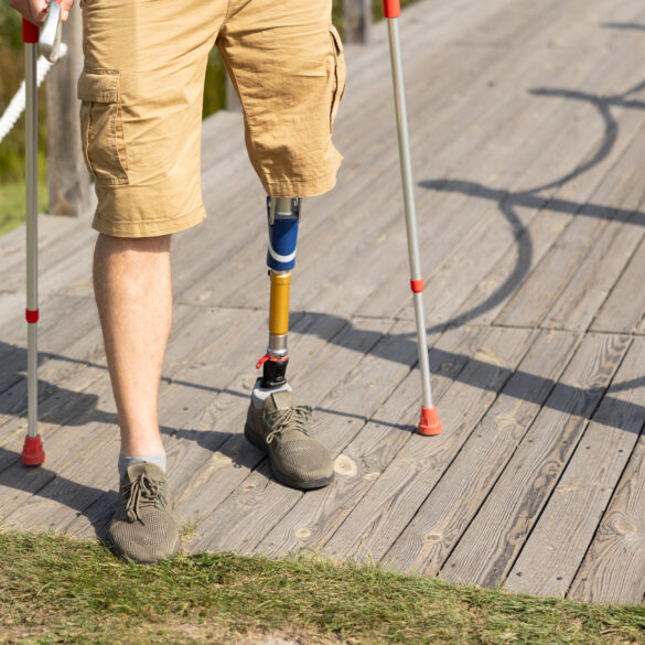 New jersey governor signs bill requiring coverage for additional prosthetic devices - photo licensed by shore news network.