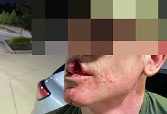 Federal officer slashed in the face by twice-deported criminal alien