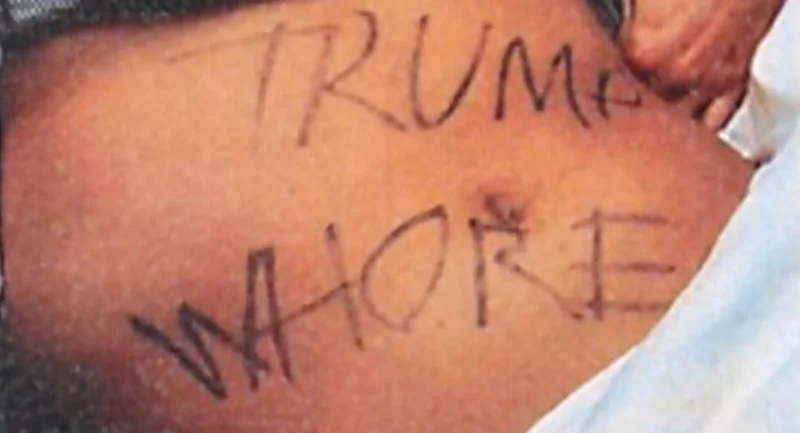 New jersey congressional aide who faked violent "trump fueled" attack facing five years in prison | photo licensed by shore news network. New jersey congressional aide who faked violent "trump fueled" attack facing five years in prison - photo licensed by shore news network.