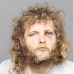 Mugshot of a bearded man with long curly hair and a bruise around his left eye, bloodstains on a gray shirt, neutral expression.