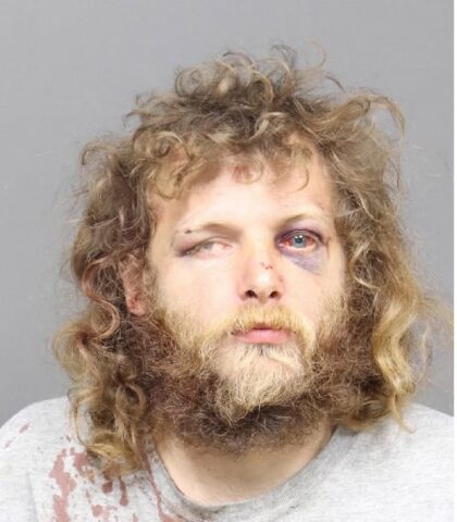 Mugshot of a bearded man with long curly hair and a bruise around his left eye, bloodstains on a gray shirt, neutral expression.
