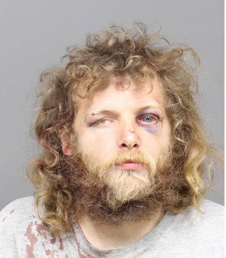 Mugshot of a bearded man with long curly hair and a bruise around his left eye, bloodstains on a gray shirt, neutral expression.