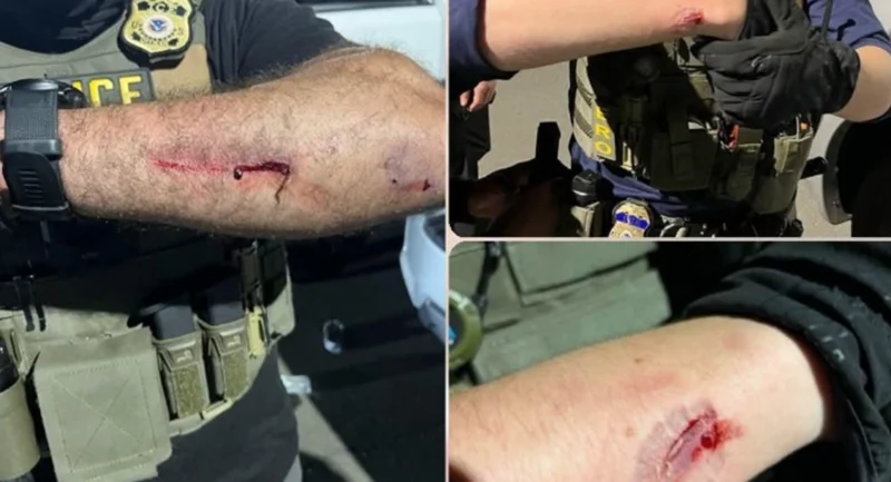 Nj ice protester who bit agent had prior arrest for child sexual offenses