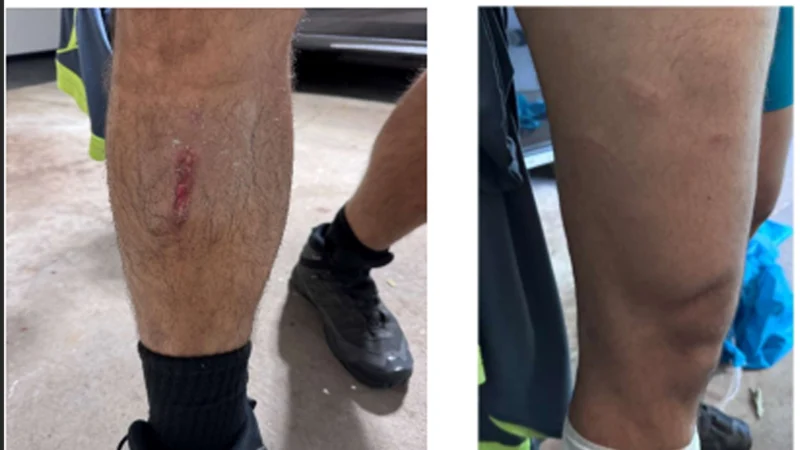 Ice captures man accused of striking federal agent in new jersey Ice captures man accused of striking federal agent in new jersey