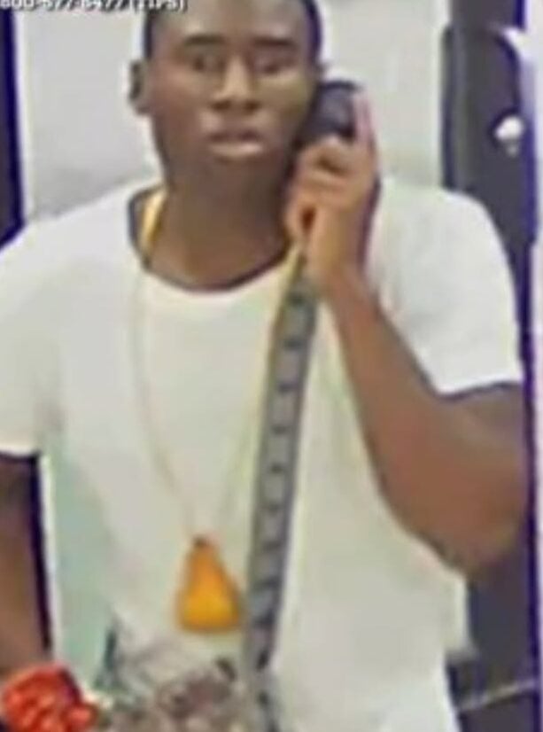 75-year-old man suffers fractured eye socket in unprovoked midtown attack