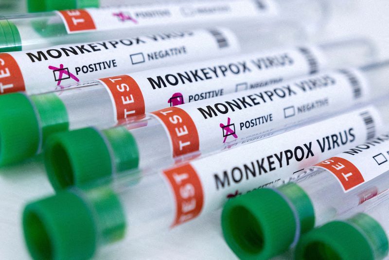 Los Angeles reports area's first death due to monkeypox