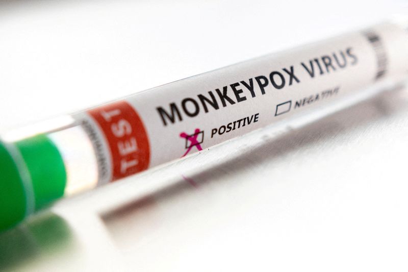 U.S. confirms 9 monkeypox cases in 7 states