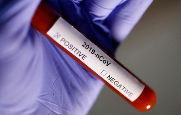 Volunteers wanted to catch COVID in the name of science