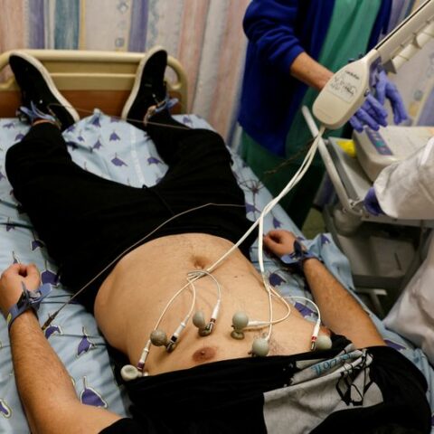 Nerve damage may explain some cases of long covid -u. S. Study - photo licensed by shore news network.