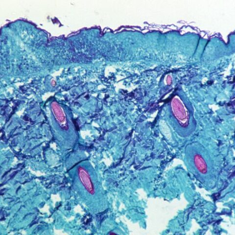 Disease experts call on who, governments for more action on monkeypox - photo licensed by shore news network.