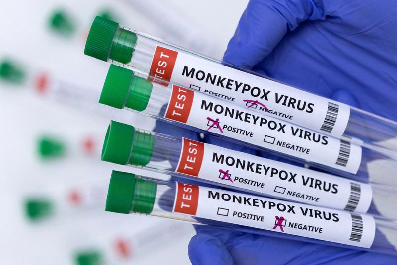 WHO set to decide if monkeypox represents health emergency