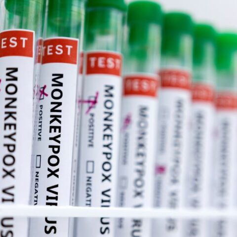 Who plans to rename monkeypox to 'mpox' - politico - photo licensed by shore news network.