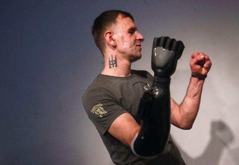 Ukrainian soldiers receive 'bionic' prostheses in Mexico