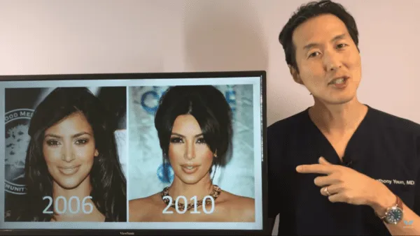 Kim Kardashians ever changing face analyzed by plastic surgeon Kim Kardashians ever changing face analyzed by plastic surgeon