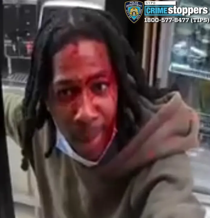 Man hospitalized with fractured skull after Brooklyn street assault Man hospitalized with fractured skull after Brooklyn street assault